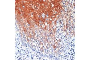 Immunohistochemistry of paraffin-embedded human tonsil using S100 antibody (ABIN7270129) at dilution of 1:200 (40x lens).