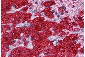 Human Adrenal: Formalin-Fixed, Paraffin-Embedded (FFPE) (GSTA3 抗体  (AA 1-223))