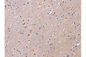 The image on the left is immunohistochemistry of paraffin-embedded Human brain tissue using ABIN7191189(KCNK3 Antibody) at dilution 1/20, on the right is treated with synthetic peptide. (KCNK3 抗体)