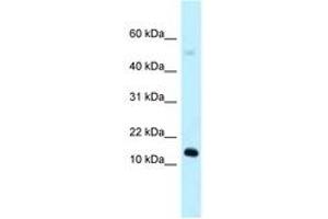 Image no. 1 for anti-RIKEN CDNA 1110059E24 Gene (1110059E24RIK) (AA 39-88) antibody (ABIN6747928) (1110059E24Rik 抗体  (AA 39-88))