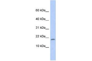 WB Suggested Anti-RPS15 Antibody Titration: 0. (RPS15 抗体  (Middle Region))