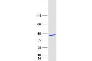 Western Blotting (WB) image for Acyl-CoA Dehydrogenase Family, Member 8 (Acad8) protein (Myc-DYKDDDDK Tag) (ABIN2714298)