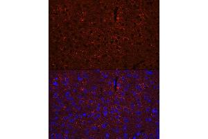 Immunofluorescence (IF) image for anti-Glutamate Decarboxylase 2 (Pancreatic Islets and Brain, 65kDa) (GAD2) (AA 401-585) antibody (ABIN3021188)