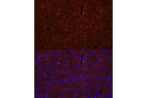 Immunofluorescence analysis of mouse brain using G Rabbit pAb (ABIN3021187, ABIN3021188, ABIN3021189 and ABIN6214056) at dilution of 1:100 (40x lens). (GAD65 抗体  (AA 401-585))