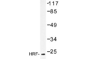 Image no. 1 for anti-Tumor Protein, Translationally-Controlled 1 (TPT1) antibody (ABIN272165) (TPT1 抗体)