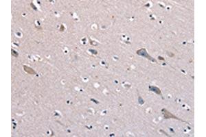 The image on the left is immunohistochemistry of paraffin-embedded Human brain tissue using ABIN7129969(KCNQ5 Antibody) at dilution 1/60, on the right is treated with fusion protein. (KCNQ5 抗体)
