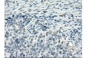 Immunohistochemical staining of paraffin-embedded colon tissue using anti-PDE10A mouse monoclonal antibody. (PDE10A 抗体)
