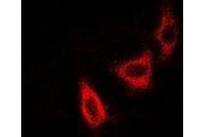 Immunofluorescent analysis of NUDE staining in SKOV3 cells. (NudE Neurodevelopment Protein 1 (NDE1) 抗体)