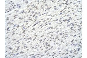Rabbit Anti-SUPT6H antibody        Paraffin Embedded Tissue:  Human Heart cell   Cellular Data:  Epithelial cells of renal tubule  Antibody Concentration:   4. (Spt6 抗体  (N-Term))