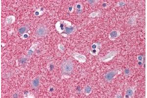 Human Brain, Cortex: Formalin-Fixed, Paraffin-Embedded (FFPE) (Septin 3 抗体  (AA 15-26))