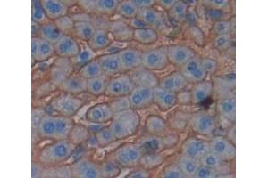 IHC-P analysis of Mouse Tissue, with DAB staining. (PIGR 抗体  (AA 352-457))