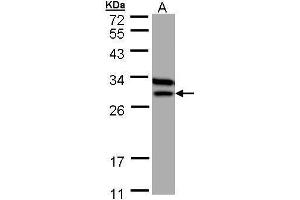 WB Image Sample (30 ug of whole cell lysate) A: MOLT4 , 12% SDS PAGE antibody diluted at 1:1000 (ETFB 抗体)