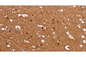 Immunohistochemistry of paraffin-embedded Human brain using HDLBP Polyclonal Antibody at dilution of 1:50 (HDLBP 抗体)