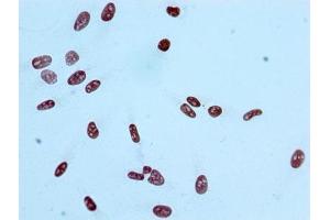 Immunocytochemistry analysis of ABIN7127265 diluted at 1:100 and staining in Hela cells performed on a Leica BondTM system. (Recombinant HIST1H2AB 抗体  (acLys9))