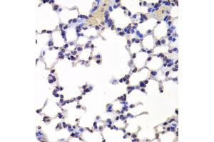 Immunohistochemistry of paraffin-embedded mouse lung using INTS6 Antibody (ABIN5973991) at dilution of 1/100 (40x lens). (INTS6 抗体)