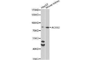 Western blot analysis of extracts of various cell lines, using ACSS2 antibody (ABIN6292756) at 1:1000 dilution. (ACSS2 抗体)