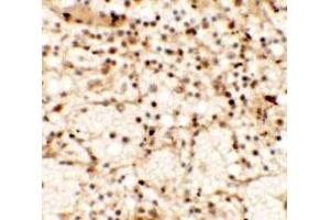 Immunohistochemical anyalysis of human spleen tissue with CLEC7A polyclonal antibody  at 5 ug/mL. (CLEC7A 抗体  (Internal Region))