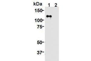 Western Blotting (WB) image for anti-Kinesin Family Member 11 (KIF11) (AA 1-1056), (N-Term) antibody (ABIN1449287) (KIF11 抗体  (N-Term))