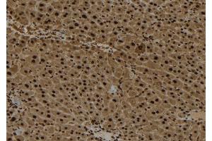 ABIN6272892 at 1/100 staining Mouse liver tissue by IHC-P. (AIMP2 抗体  (Internal Region))