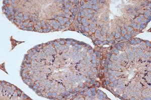 Immunohistochemistry of paraffin-embedded mouse testis using STK3/MST2 Rabbit mAb (ABIN7270223) at dilution of 1:100 (40x lens). (STK3 抗体)