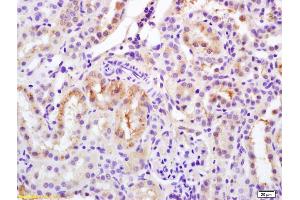 Formalin-fixed and paraffin embedded rat kidney labeled with Rabbit Anti Phospho-Bcl-2(Ser70) Polyclonal Antibody, Unconjugated (ABIN683428) at 1:200 followed by conjugation to the secondary antibody and DAB staining (Bcl-2 抗体  (pSer70))