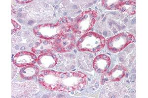 Anti-Klotho antibody IHC of human kidney. (Klotho 抗体  (AA 251-300))