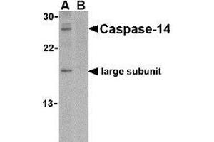 Western blot analysis of caspase-14 in Jurkat cell lysate in the (A) absence or (B) presence of blocking peptide with AP30195PU-N caspase-14 antibody at 1 μg/ml. (CASP14 抗体  (C-Term))