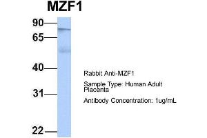 Host: Rabbit Target Name: MZF1 Sample Type: Human Adult Placenta Antibody Dilution: 1. (MZF1 抗体  (N-Term))