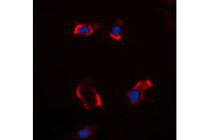 Immunofluorescence (IF) image for anti-Cytochrome P450, Family 2, Subfamily S, Polypeptide 1 (CYP2S1) (Center) antibody (ABIN7300598)
