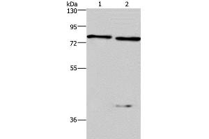 Western Blot analysis of Mouse brain and kindey tissue using COL4A3BP Polyclonal Antibody at dilution of 1:300 (COL4A3BP 抗体)