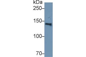 Detection of ORP150 in Human Serum using Polyclonal Antibody to 150 kDa Oxygen Regulated Protein (ORP150) (150 kDa Oxygen Regulated Protein (AA 695-994) 抗体)