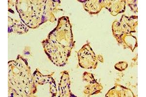 Immunohistochemistry of paraffin-embedded human placenta tissue using ABIN7164785 at dilution of 1:100 (P4HA2 抗体  (AA 236-535))