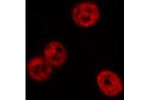 ABIN6277977 staining CoLo cells by IF/ICC. (FYB 抗体)