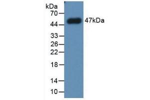 Detection of Recombinant PAI1, Human using Monoclonal Antibody to Plasminogen Activator Inhibitor 1 (PAI1) (PAI1 抗体)