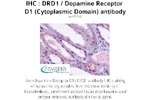 Image no. 1 for anti-Dopamine Receptor D1 (DRD1) (3rd Cytoplasmic Domain) antibody (ABIN1733780) (Dopamine Receptor d1 抗体  (3rd Cytoplasmic Domain))