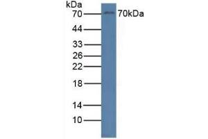 Detection of RYK in Human Jurkat Cells using Polyclonal Antibody to Related To Receptor Tyrosine Kinase (RYK) (RYK 抗体  (AA 287-533))