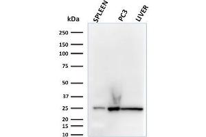 Western Blotting (WB) image for anti-Complement Component 1, Q Subcomponent, A Chain (C1QA) (AA 104-237) antibody (ABIN6940764)