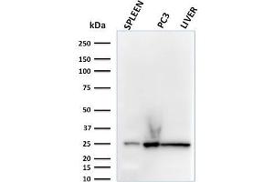 Western Blot Analysis of human spleen, PC3 and liver lysates using C1QA Mouse Monoclonal Antibody (C1QA/2783). (C1QA 抗体  (AA 104-237))