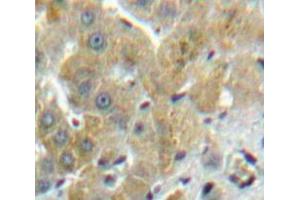 Used in DAB staining on fromalin fixed paraffin-embedded Liver tissue (FUCA1 抗体  (AA 170-420))