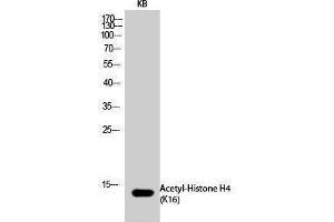 Western Blotting (WB) image for anti-Histone H4 (acLys16) antibody (ABIN3179374) (Histone H4 抗体  (acLys16))