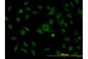 Immunofluorescence (IF) image for anti-Stromal Antigen 1 (STAG1) (AA 1112-1221) antibody (ABIN564458)