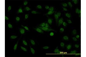 Immunofluorescence of monoclonal antibody to STAG1 on HeLa cell. (Stromal Antigen 1 抗体  (AA 1112-1221))