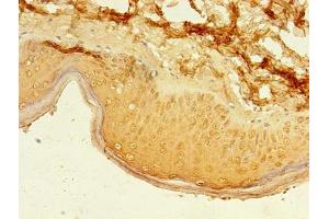 Immunohistochemistry of paraffin-embedded human skin tissue using ABIN7162495 at dilution of 1:100