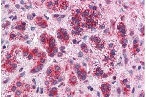 Human Adrenal: Formalin-Fixed, Paraffin-Embedded (FFPE) (TMEM33 抗体  (Internal Region))
