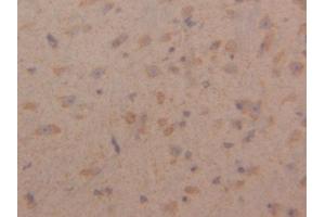DAB staining on IHC-P; Samples: Mouse Cerebrum Tissue (Peroxiredoxin 3 抗体  (AA 64-257))