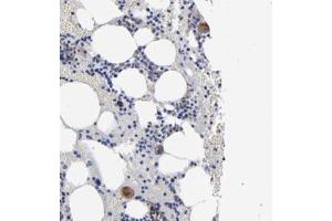 Immunohistochemical staining of human bone marrow with EMILIN1 polyclonal antibody  shows moderate cytoplasmic positivity in megakaryocytes. (Emilin1 抗体)