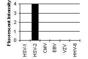 Immunofluorescence (IF) image for anti-Herpes Simplex Virus Type 2, Glycoprotein G (HSV2 gG) antibody (ABIN265564)