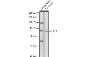Western Blotting (WB) image for anti-Follicle Stimulating Hormone Receptor (FSHR) (AA 631-695) antibody (ABIN3022002)