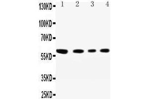 Western Blotting (WB) image for anti-Cell Adhesion Molecule 1 (CADM1) (AA 73-92), (N-Term) antibody (ABIN3042543) (CADM1 抗体  (N-Term))