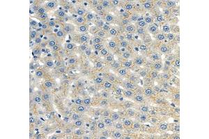 Immunohistochemistry of paraffin embedded mouse liver using CEACAM1 (ABIN7073315) at dilution of 1: 650 (400x lens) (CEACAM1 抗体)